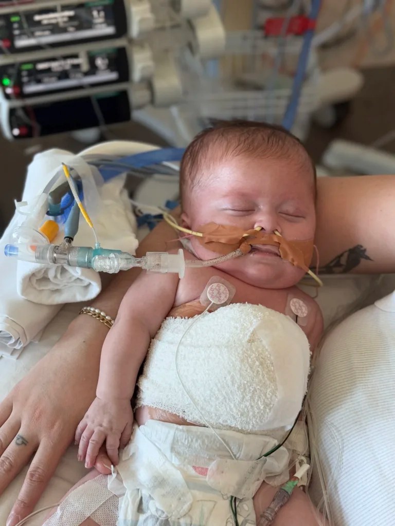 RCH patient, Luca hooked up to pre-existing ventilator